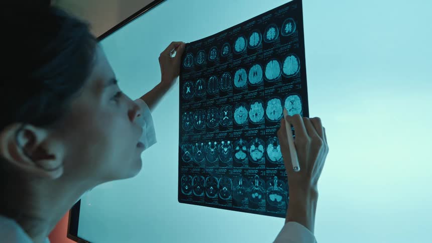 A female doctor carefully analyzes a patient's brain MRI scan on a large glowing screen
