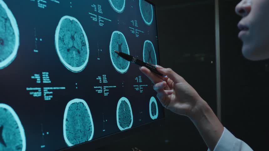 A female doctor meticulously examines a series of brain scans displayed on a large computer monitor in a dark, modern lab