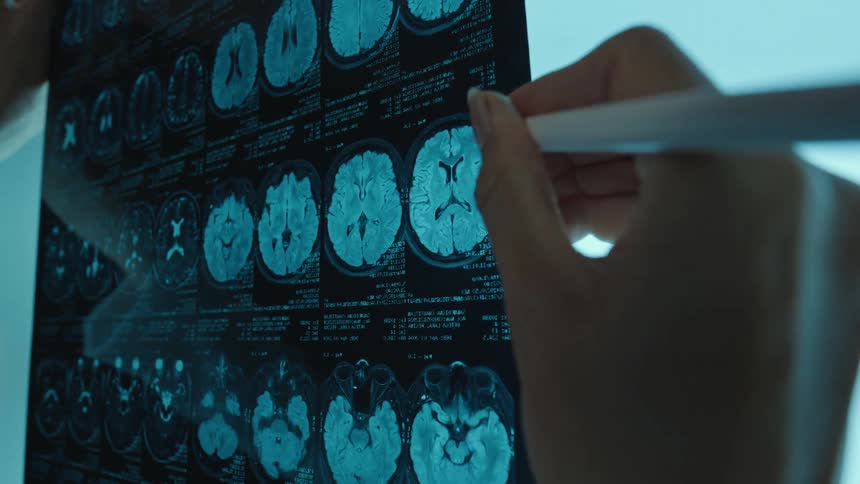 A female doctor uses a digital stylus to closely examine a patient's brain MRI scan on a futuristic glowing tablet