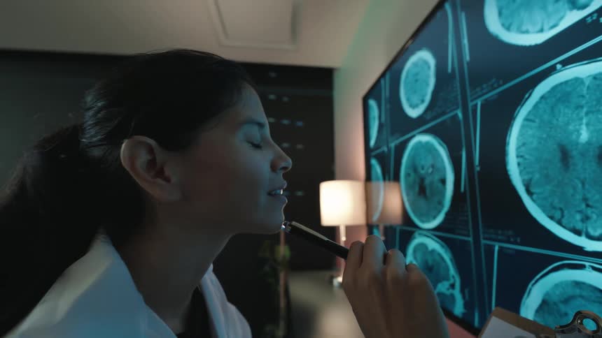 A thoughtful female doctor in a dark office studies a patient's brain scans on a large screen