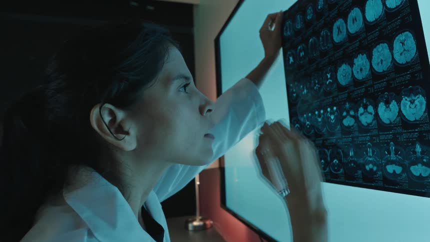 A focused female doctor in a dark office meticulously examines a patient's brain MRI scan against a bright light source