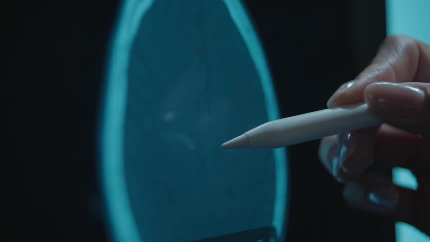A medical expert's hand uses a digital pen to examine an animated CT scan of a human brain on a screen