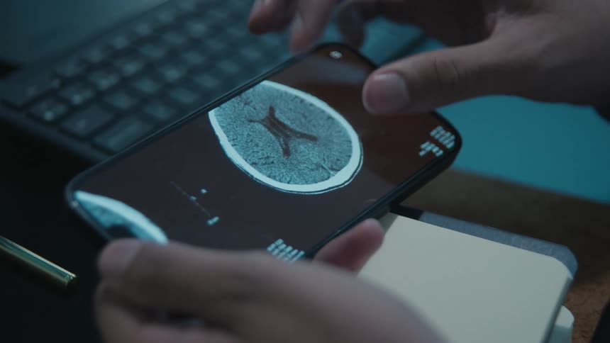 A doctor analyzes a patient's brain CT scan on a smartphone, zooming in on the details at their desk