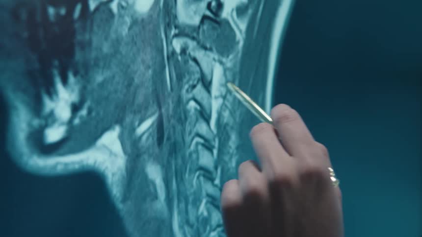 A medical professional points with a pen at a detailed MRI scan of a human cervical spine