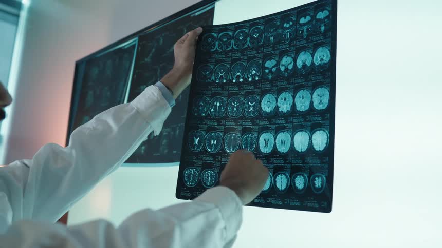 A doctor in a white lab coat carefully analyzes a patient's brain MRI scans against a light box in a modern hospital room