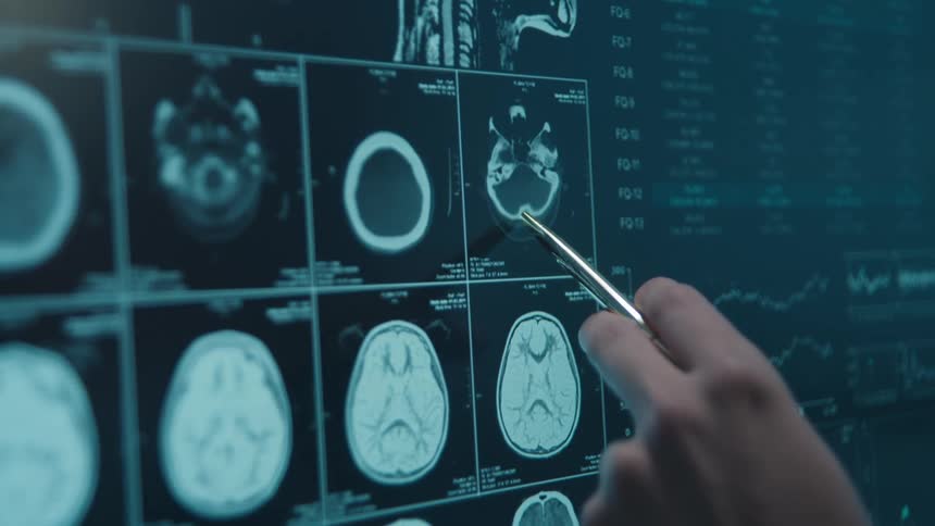 A medical professional uses a pen to meticulously examine various MRI and CT scans of a human brain on a futuristic digital display