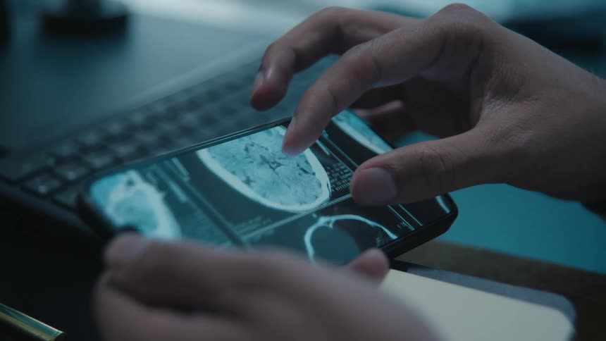 A doctor carefully examines a patient's brain CT scan on a smartphone, zooming in for a detailed analysis