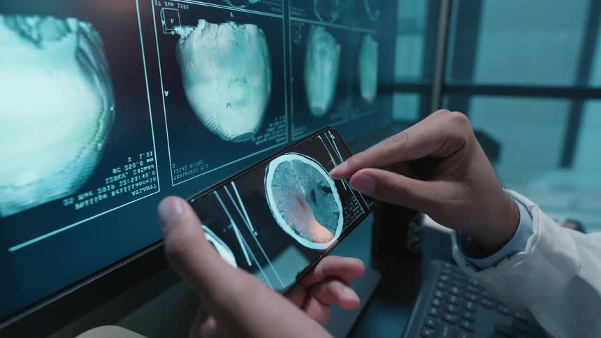 Close-up of a doctor's hands analyzing a patient's brain scan on a smartphone, with detailed medical imaging on a monitor in the background