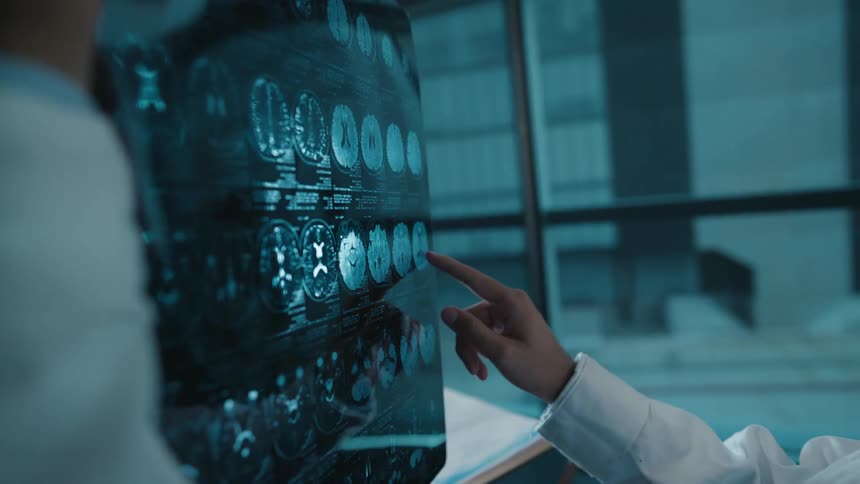 A doctor's hand points to a specific area on a patient's brain MRI scan during a consultation with a colleague