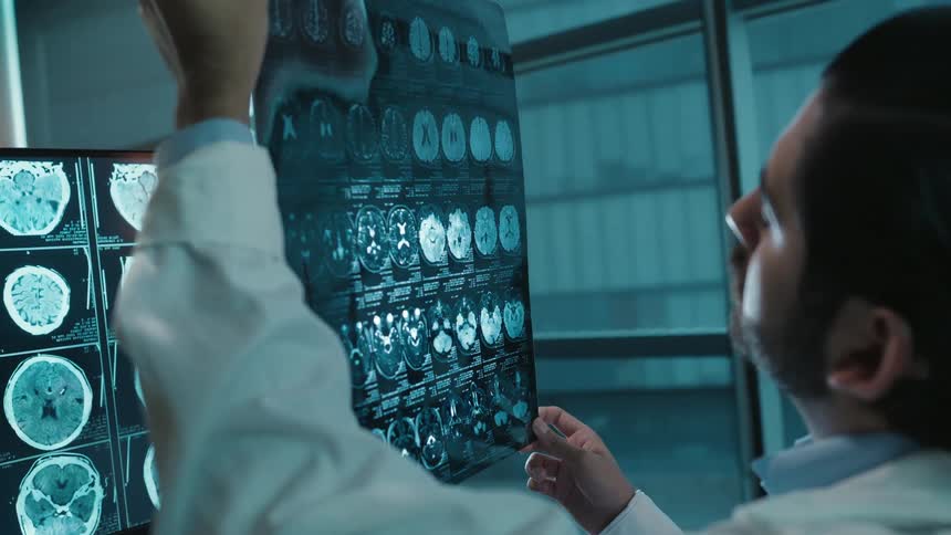 A focused doctor in a white coat holds up a patient's brain MRI scan, comparing it with images on a computer monitor in a dimly lit office