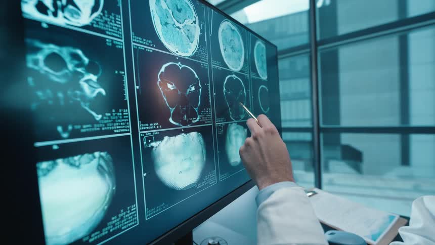 A doctor points a pen at a computer monitor, meticulously analyzing CT and MRI scans of a patient's brain and skull in a modern hospital office