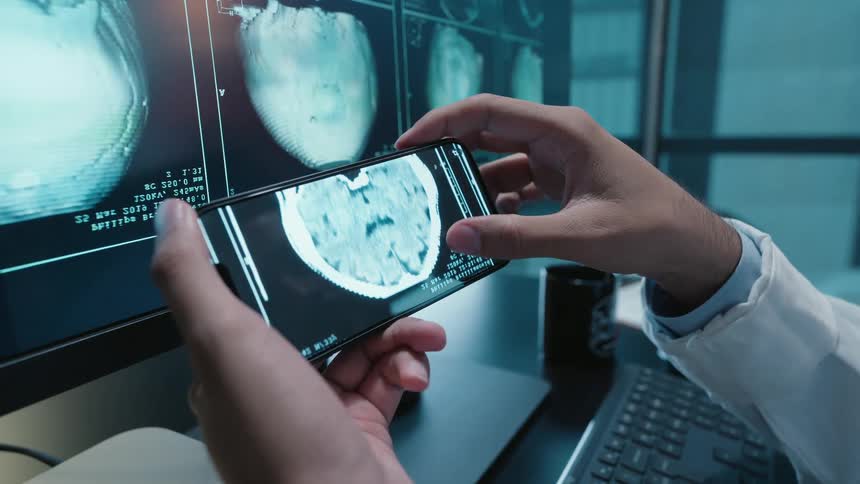 A medical professional closely examines a patient's brain scan on a smartphone, zooming in to analyze the details