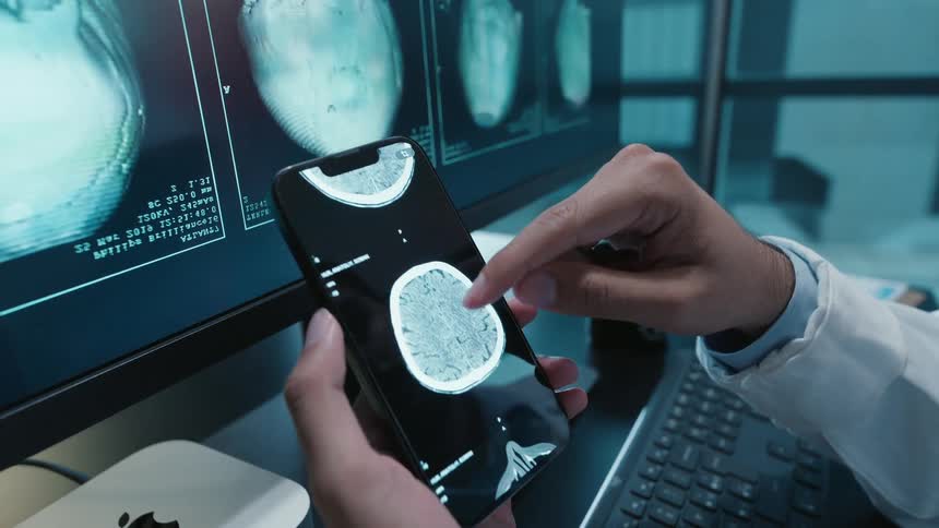 A doctor closely examines a patient's brain CT scan on a smartphone, zooming in to analyze the details for a diagnosis