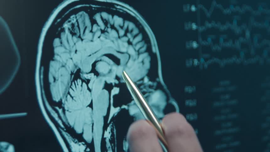 A medical professional points with a pen to different sections of a sagittal brain MRI on a high-tech display