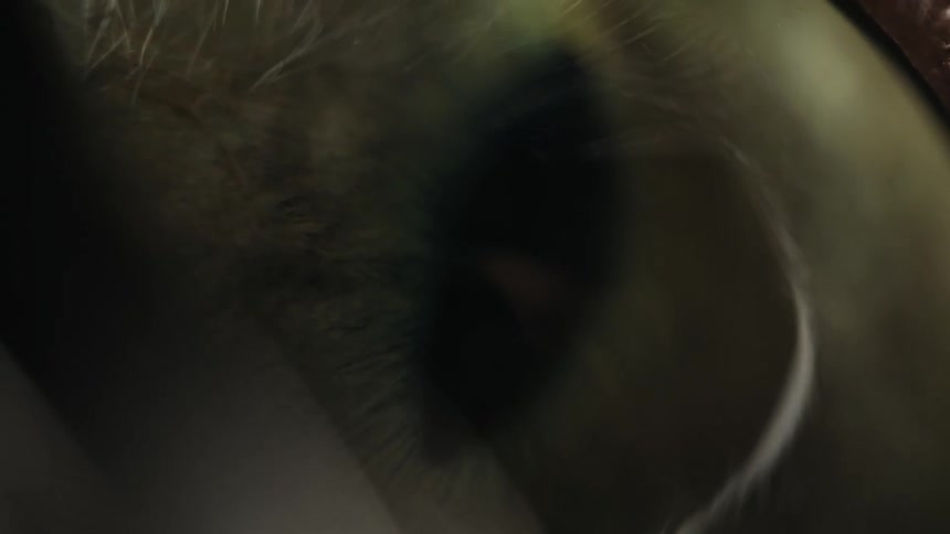 Extreme macro shot of a human eye pupil dilating and constricting during an ophthalmology exam