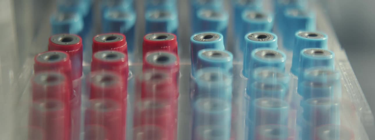 Medical test vials with red and blue tops shake rapidly inside a laboratory machine during analysis
