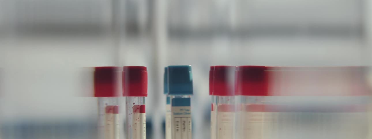 Close up of test tubes with red and blue caps spinning rapidly in a laboratory centrifuge