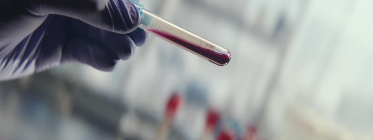 A lab technician wearing a glove carefully inspects a test tube filled with a blood sample