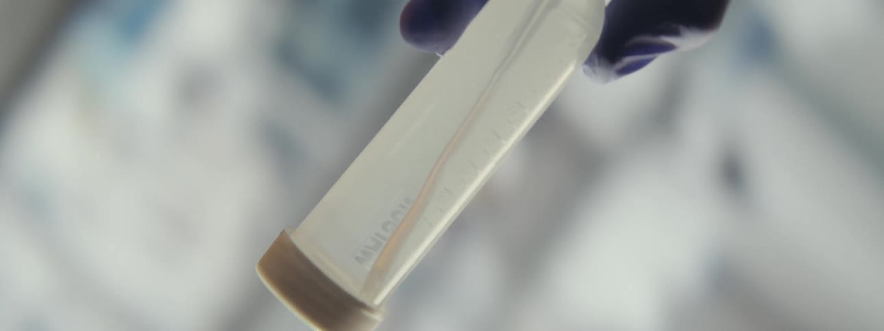 A scientist in a lab carefully examines a live parasitic worm swimming inside a specimen vial
