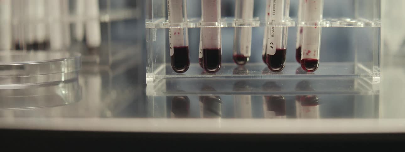 A slow pan across a clear rack holding multiple test tubes filled with blood samples in a laboratory