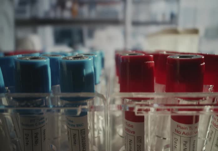 Macro shot pulling back from empty red and blue capped medical test tubes organized in a clinical laboratory