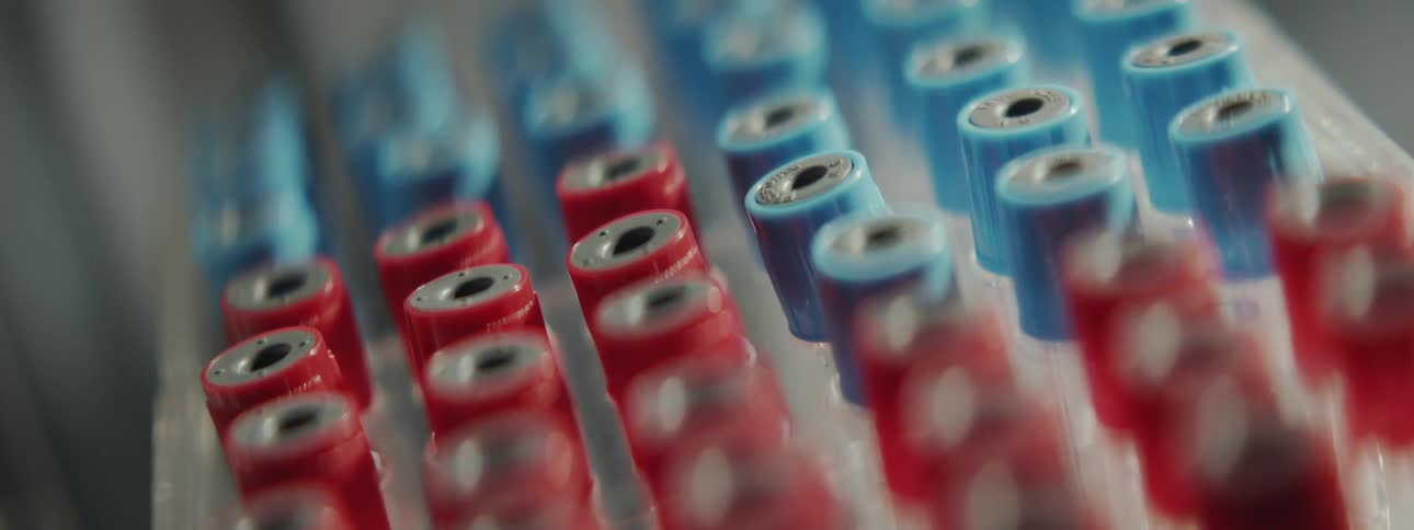 A close-up rack focus shot reveals rows of red and blue-capped blood sample vials in a laboratory test tube rack
