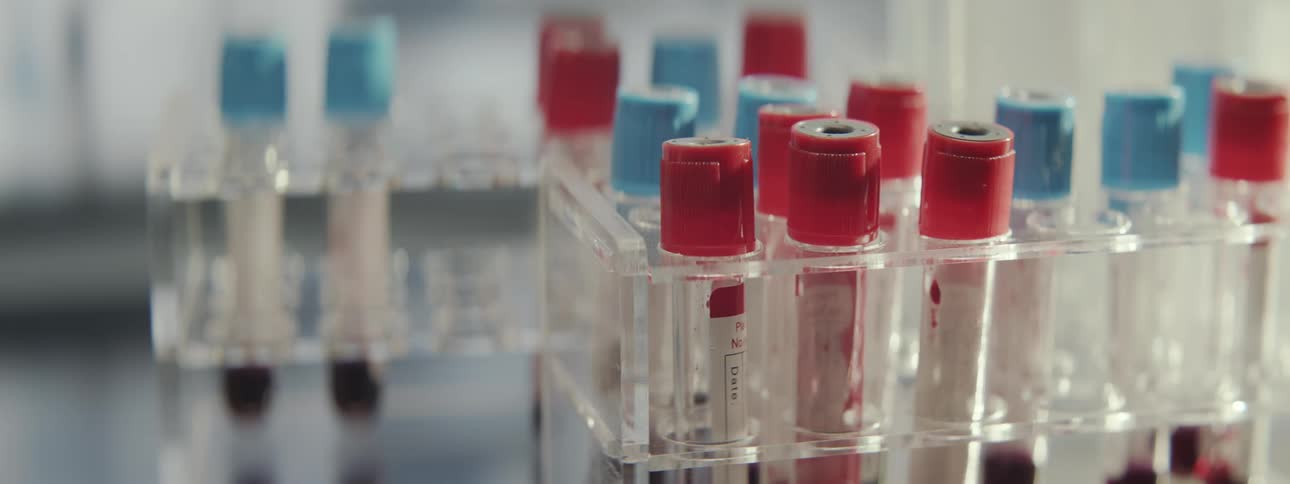 A lab technician in gloves places a test tube with a blood sample into a plastic rack in a medical laboratory