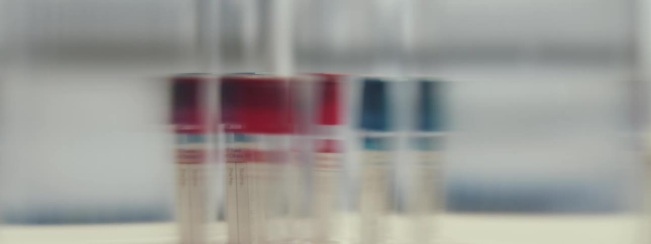 A shaky, distorted close-up shot of medical test tubes with red and blue caps in a laboratory
