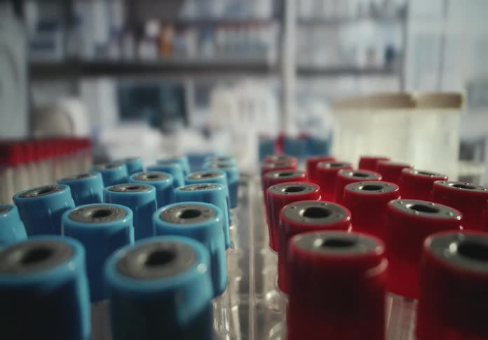 A slow pull-back shot over rows of red and blue capped test tubes in a laboratory rack