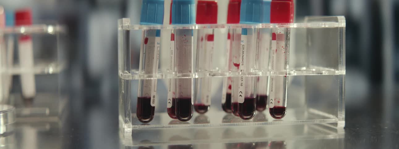 A close-up shot of a rack of test tubes containing blood samples sitting on a countertop in a medical laboratory