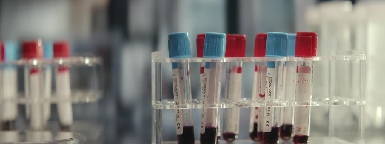 A gloved hand carefully places a vial of blood into a test tube rack within a sterile laboratory setting