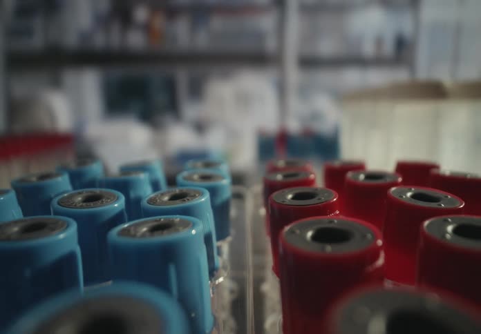 A slow slider shot pulls back revealing rows of blue and red capped test tubes organized in a rack within a modern science laboratory