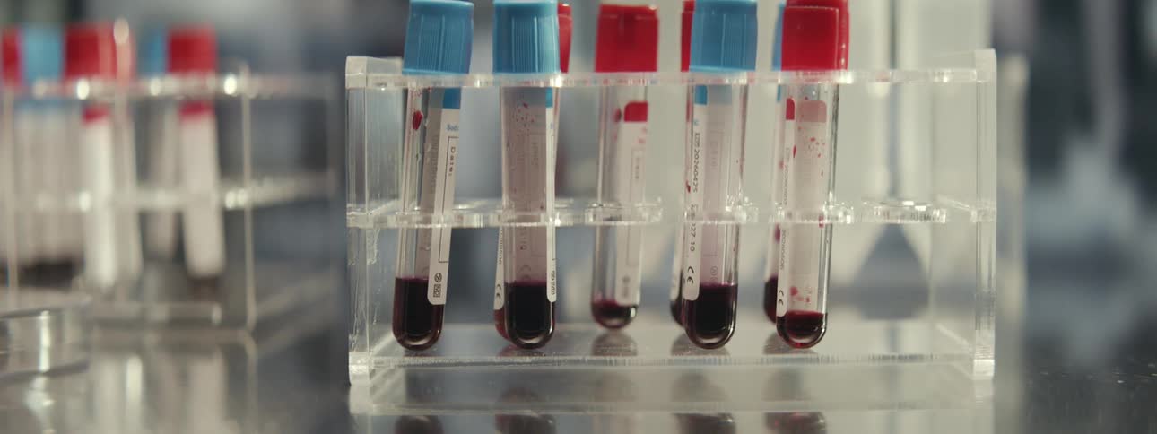 Static close-up shot of blood sample test tubes in a clear rack within a clinical laboratory setting