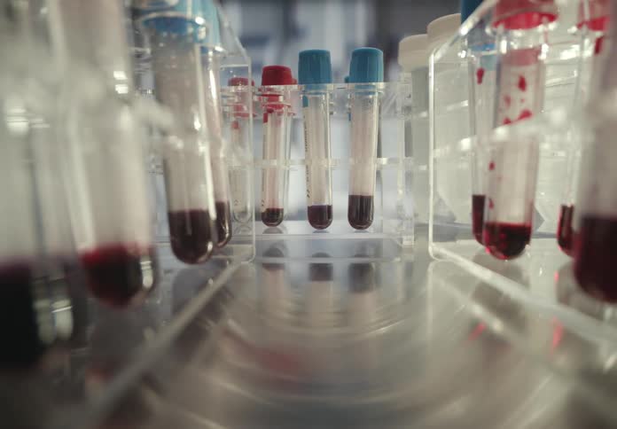 A slow dolly shot reveals rows of test tubes filled with blood samples in a sterile medical laboratory