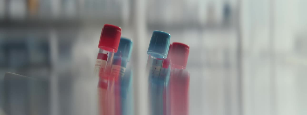 Close-up of test tubes with blood samples spinning rapidly in a medical laboratory centrifuge