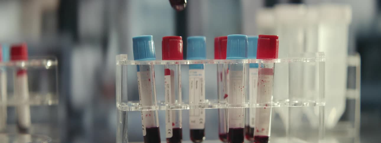 Slow motion close up of a gloved hand removing a blood sample vial from a test tube rack in a medical lab