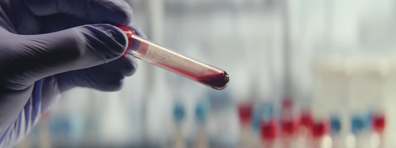 A medical professional's gloved hand holds and swirls a test tube containing a blood sample for analysis in a lab