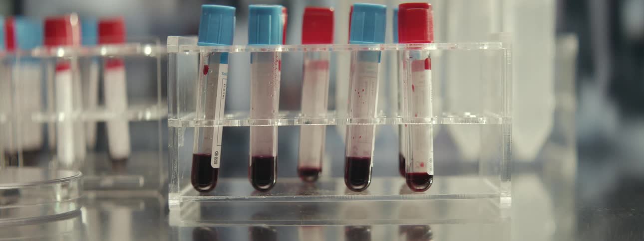 A slow zoom out on a rack of blood samples in test tubes in a clean, modern medical research laboratory