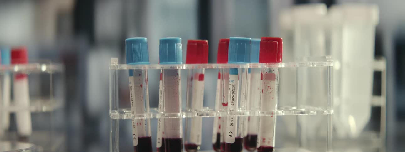 Close-up of a test tube rack holding vials of blood samples in a bright, modern medical laboratory