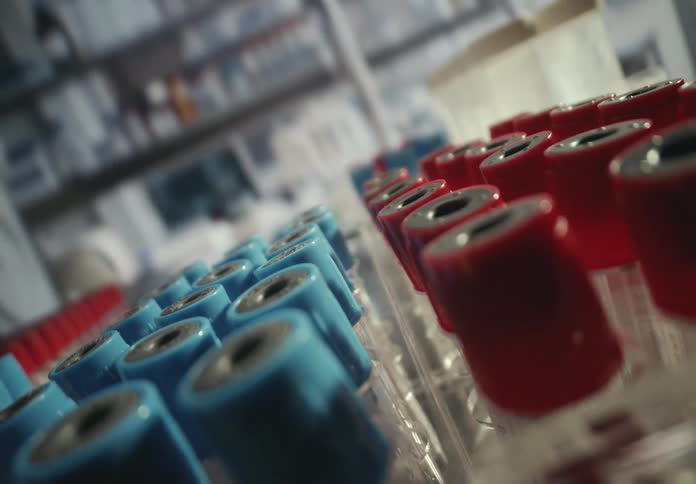 A macro slow pull-back shot reveals rows of red and blue capped test tubes in a scientific laboratory