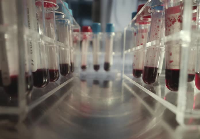 A pull-back camera shot reveals rows of test tubes filled with blood samples in a medical laboratory