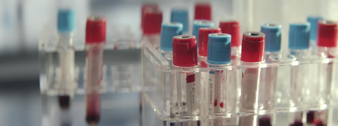 A lab technician gently shakes a test tube with a blood sample before placing it back into a rack