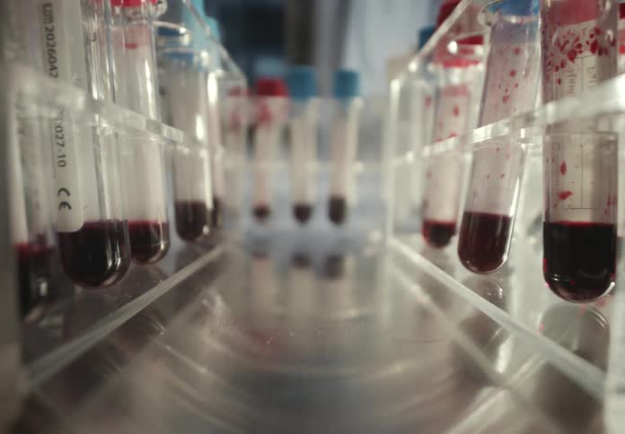 A close-up dolly shot reveals numerous blood samples in test tubes organized in racks within a modern medical laboratory