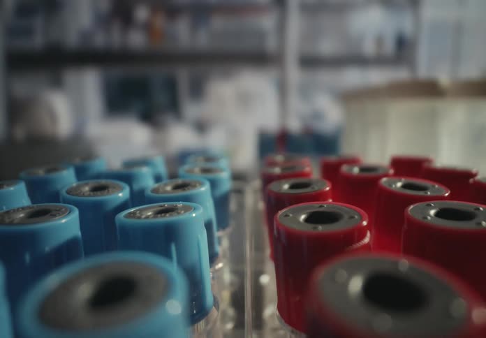A close-up dolly shot of blue and red capped blood sample test tubes organized in racks within a medical laboratory