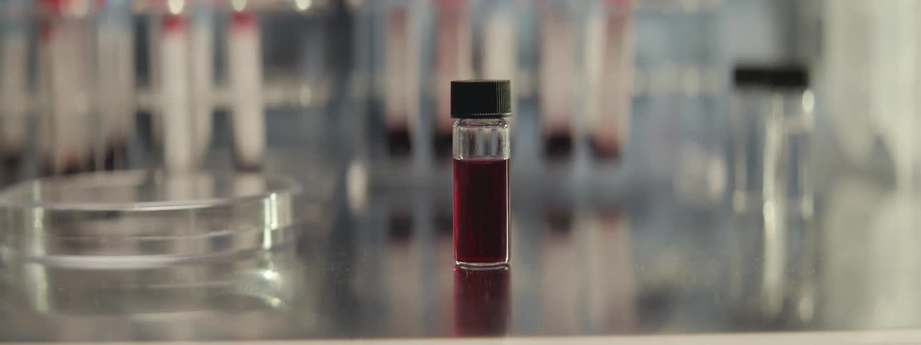 A close-up of a small glass vial containing a blood sample sits on a sterile metal surface in a scientific laboratory