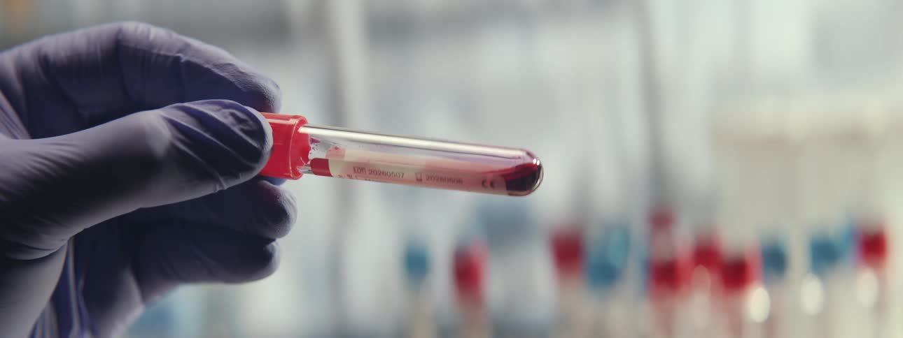 A gloved lab technician holds and examines a blood sample in a test tube