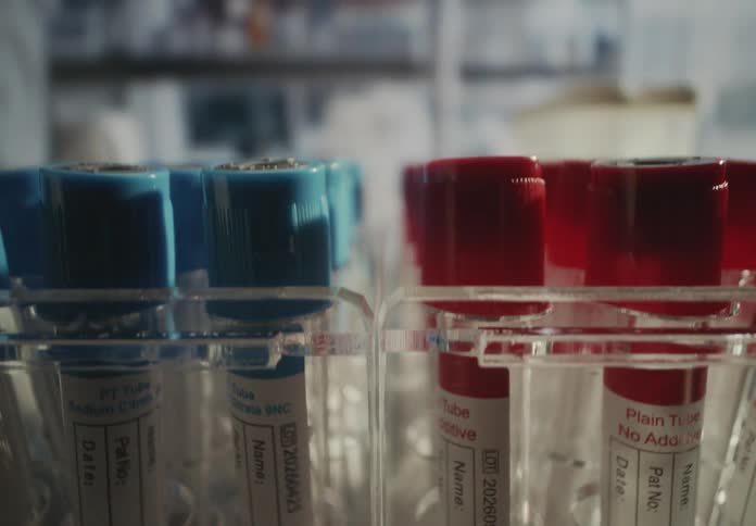 Extreme close-up dolly shot reveals racks of medical blood test tubes with blue and red caps in a modern laboratory