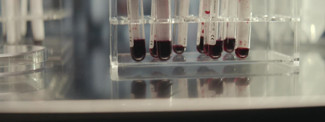 A slow pull-out shot reveals blood samples in test tubes on a rack inside a modern scientific laboratory