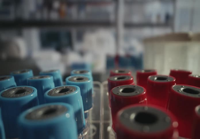 Macro dolly shot reveals rows of blue and red-capped test tubes in a rack inside a modern science laboratory