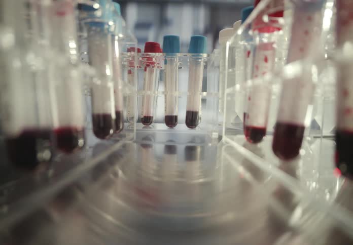 A close-up camera movement pulls back through racks of test tubes containing blood samples in a laboratory
